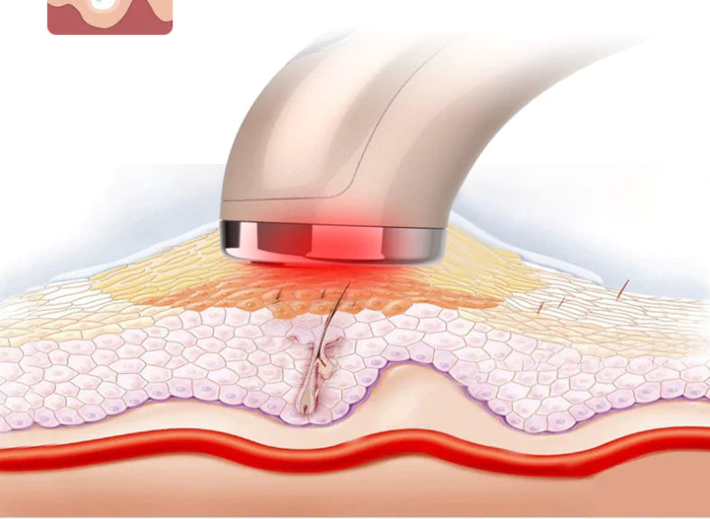 Red Light Photon Skin Rejuvenator™
