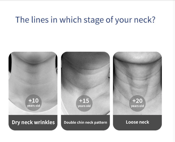 IPL Neck & Face Rejuvenator™