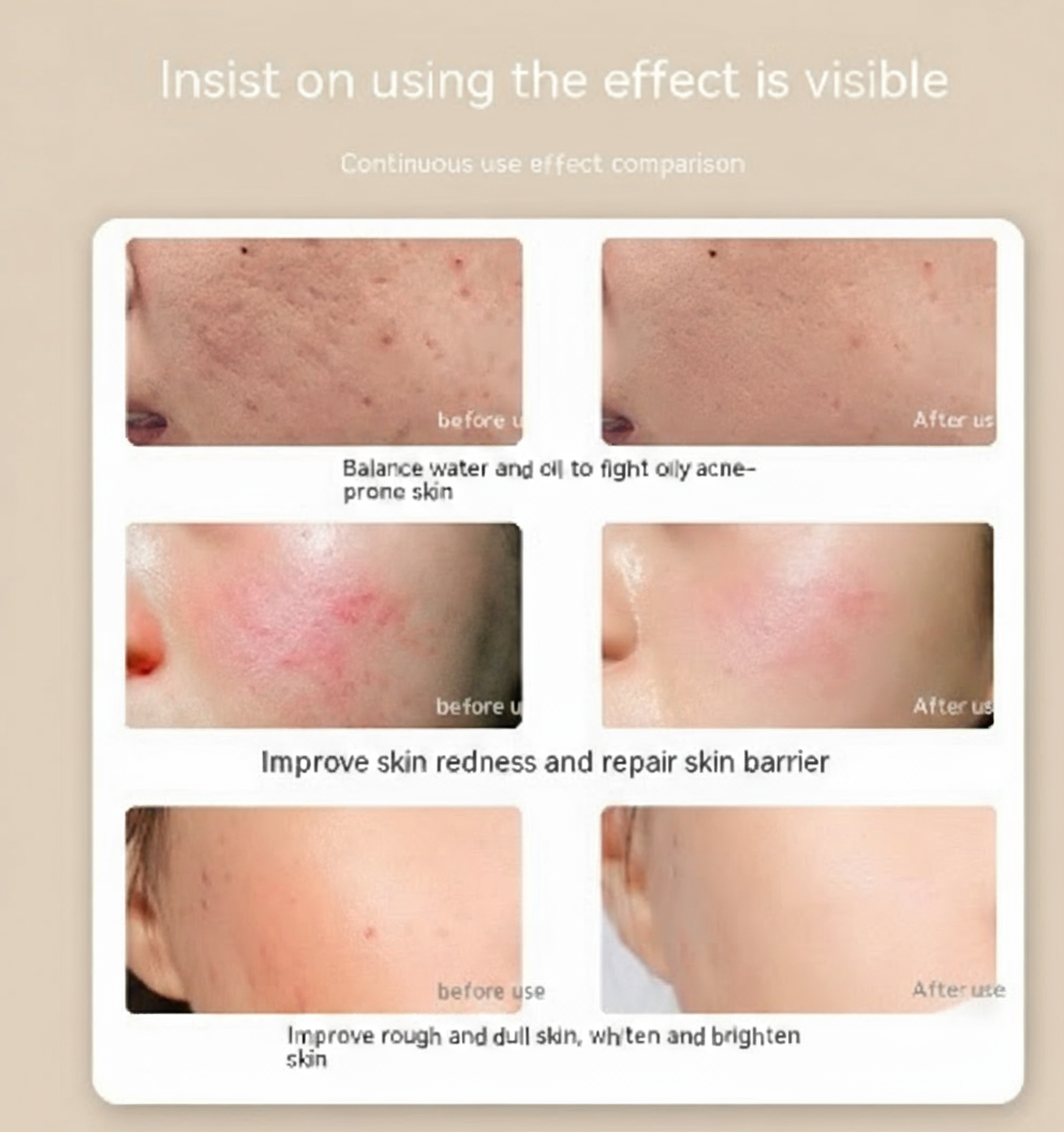 IPL Silicone Mask™