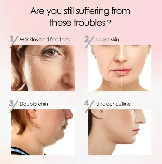 V15Lift™ Facial Lifting Device