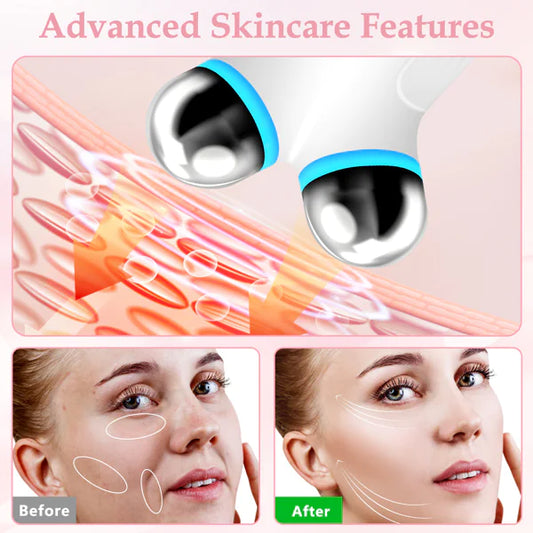 RadiLift™ EMS Facial Beauty Tool