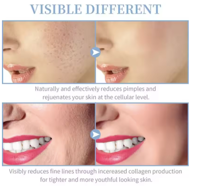 High-Frequency Electronic Beauty Device