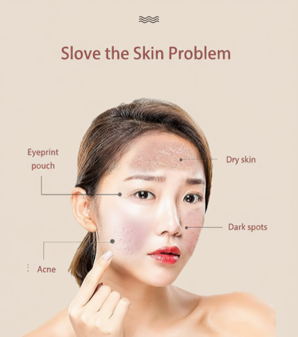 Photon Acne Treatment Facial Mask™