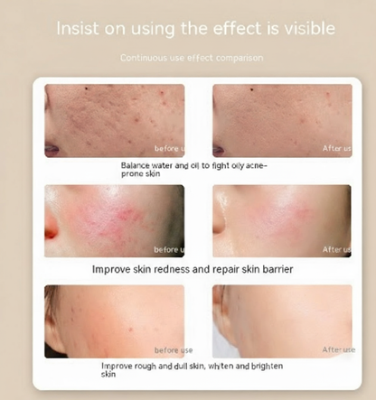 Photon IPL LED Beauty Mask™