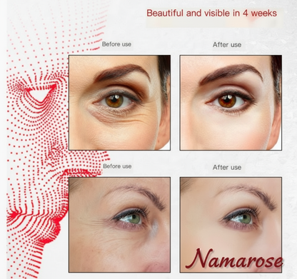 Photon Silicone Mask™